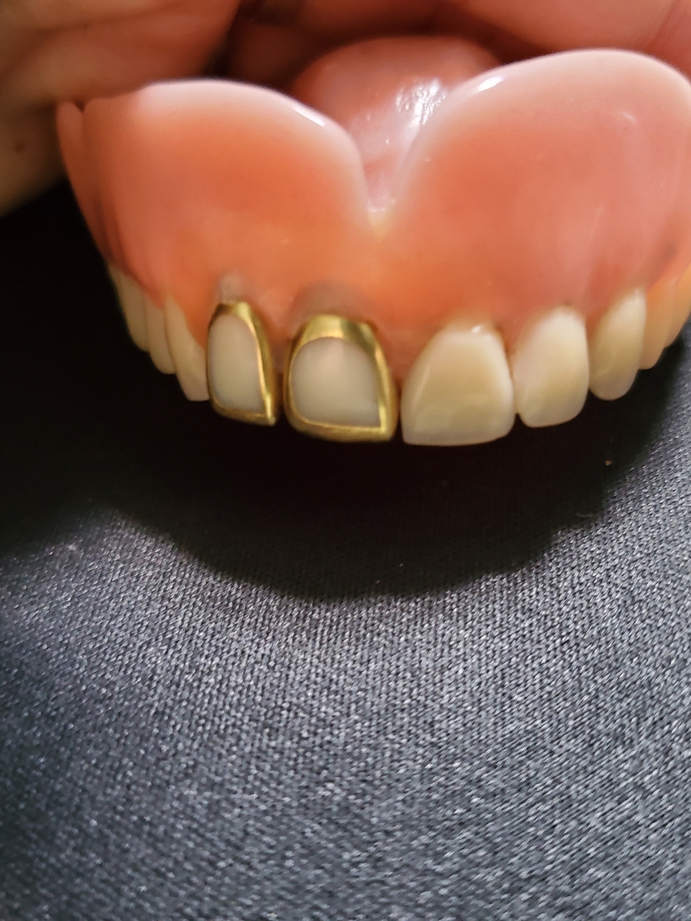 Real Gold Two-Tooth Grill Cap - Unbranded